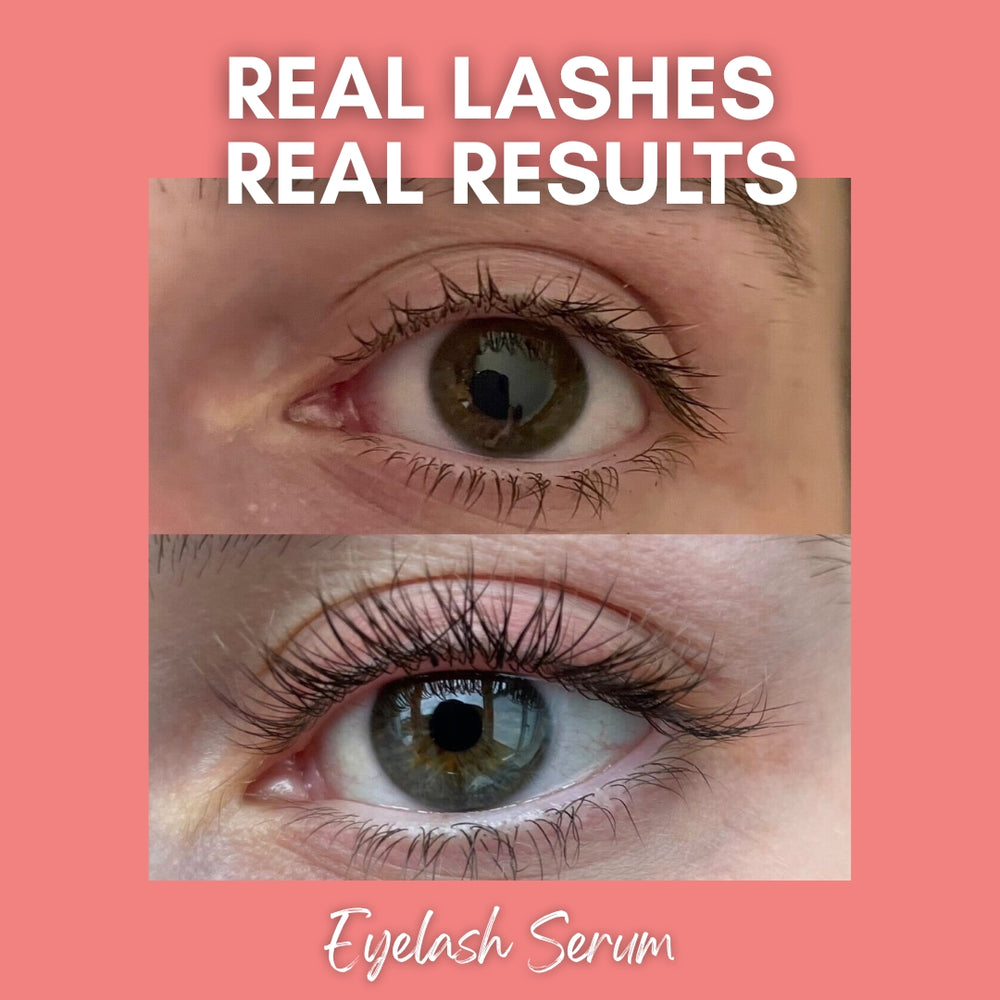 Eyelash Serum
