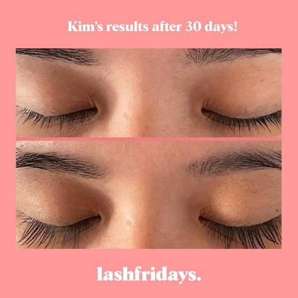Eyelash Serum - lashfridays